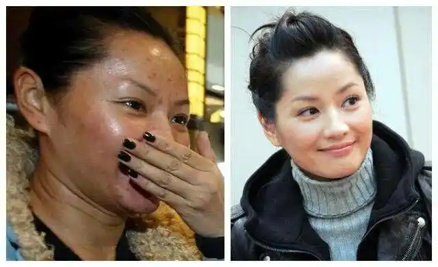 卸妆后最丑女星:瞿颖 她脸上的皮肤凹凸不平,非常油腻的肌肤,素颜照