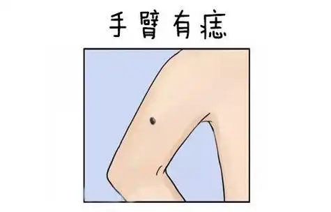 手臂外侧痣,手臂外侧痣图解