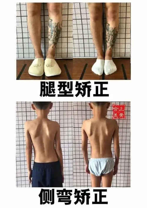 臂功能障碍,肩痛与活动障碍(前屈/后伸/外展),抬臂困难胸背痛,肩胛痛