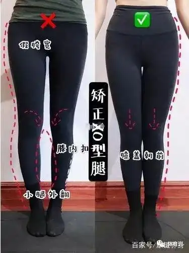 简单6个动作矫正xo型腿调整膝盖内扣让腿变得又直又长