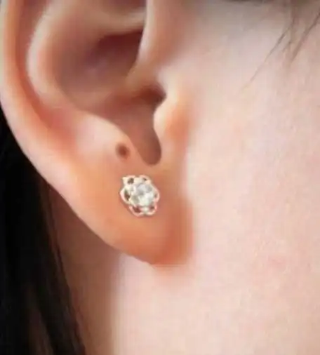 25岁女孩耳朵上有颗痣医生无意中看到后救了她一命