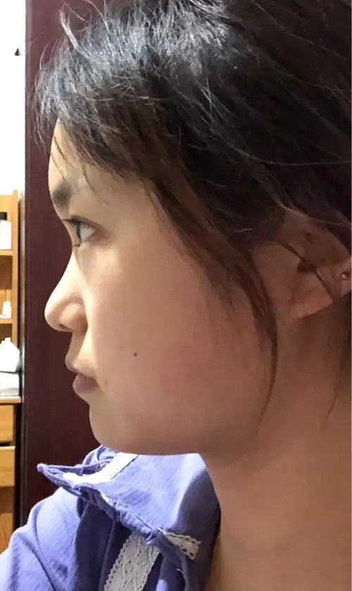 提 交  相关评论 氧气cc6fwv 不知道你正面啥样 我觉得鼻子改变一下