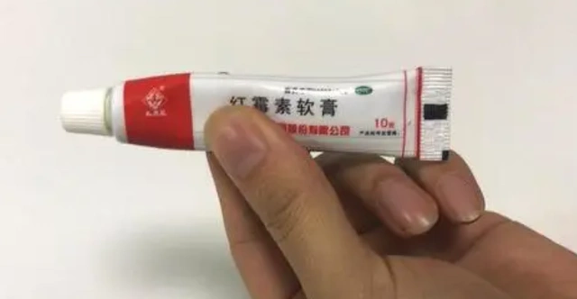 红霉素眼膏怎么用红霉素眼膏涂抹位置