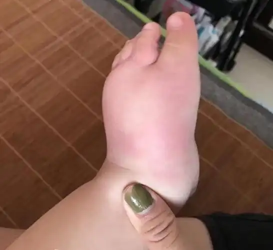 多数人不知蟑螂的天敌是啥家里头放点它让蟑螂全消失