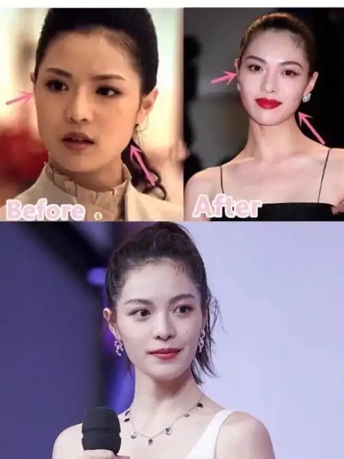 走高级脸人设的钟楚曦,整容前长这样
