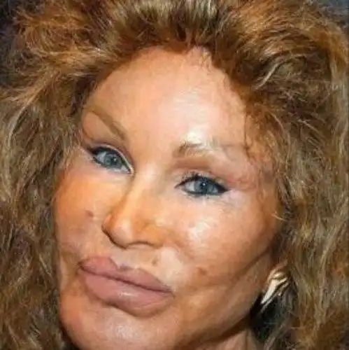 世界上五位整容失败的女明星 其中有一位来自中国