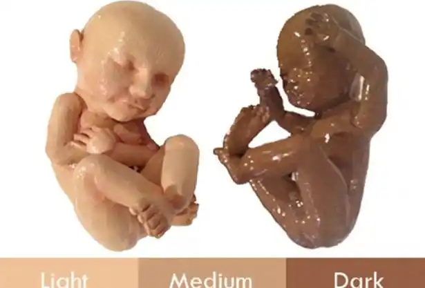 3d打印带你见未出生胎儿体位表情皮肤性别皆可见