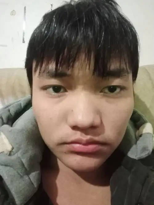 为什么我这么丑 ,我很自卑不敢抬头见人,更不够和别人对视,我很怕别人