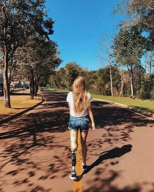 19岁车祸截肢20岁成为巴西单腿女王圈粉百万