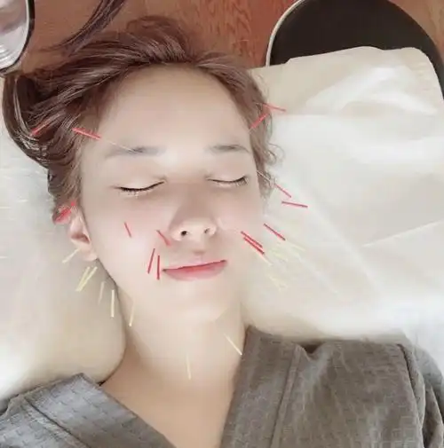 真的不敢相信整骨 针灸真的可以改善大小脸