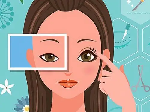 做完全切类双眼皮之后会经历哪几个阶段?