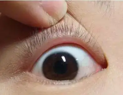 黄色的区域是眼睑,蓝色的区域是内眼线的位置,红色的区域是外眼线的