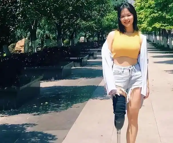 回顾河南电焊工女孩罗雨只有一条腿走红后被300名男生表白