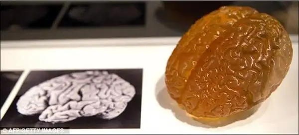 美国展出爱因斯坦大脑切片