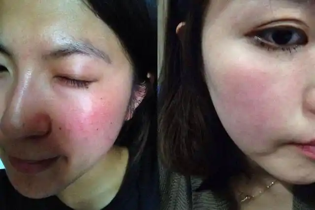 使用爽肤水时有轻微刺痛感,那么就说明你的皮肤已经出现了敏感的前兆