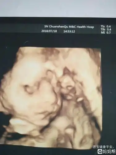 做父母!四维宝宝照"细心尽心"-第1张图片-奶酪博客