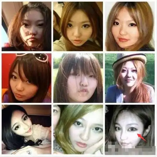 周扬青开眼角的疤,比送小猪的90万lv滑板还亮啊!