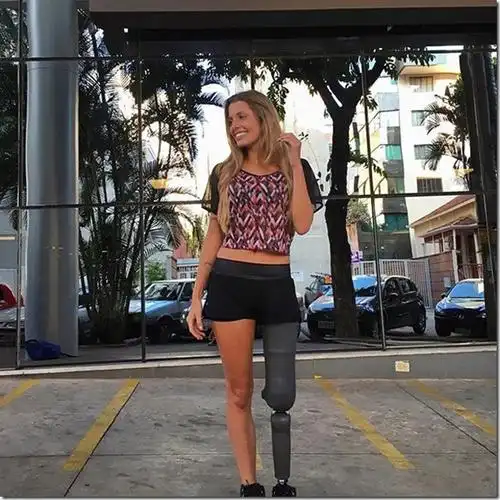 俄网巴西假肢女孩征服男人心