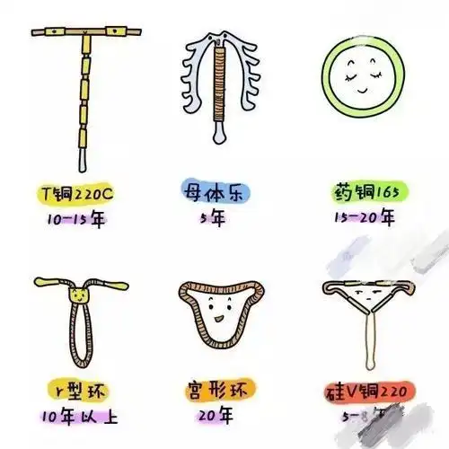 避孕环种类繁多,形状各异,各有各的优点和缺点,所以选择适合自己的