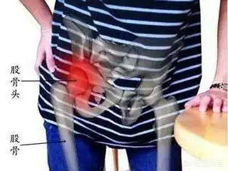 疼痛为放射性神经根痛,部位为腰骶部,臀后部,大腿后外侧,小腿外侧至跟