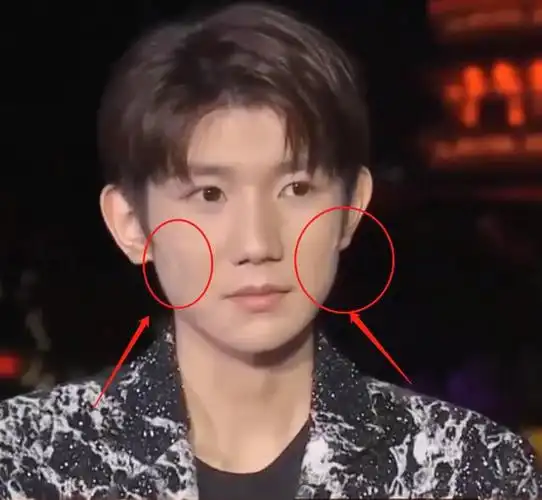 王源上央视节目无美颜直播暴露真实颜值这皮肤状态我没眼花