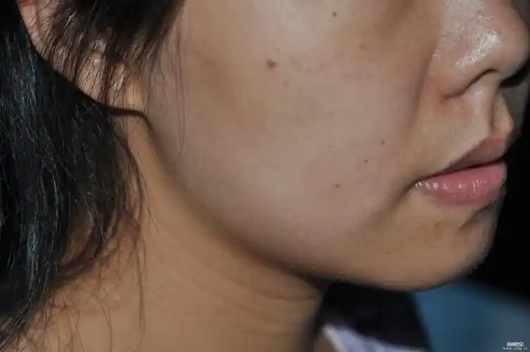 第一期全民大变身暗沉的妹子洋气转身啦