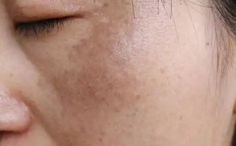 45岁后的女人不要太节约,常吃4种"零食",或能补充雌激素