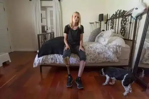 她因卫生棉条中毒而截肢!如今却凭借一条金腿让时尚圈目瞪口呆.