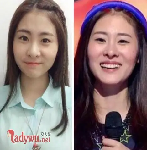 张碧晨的鼻子好奇怪 鼻型变了很多次整容了吗