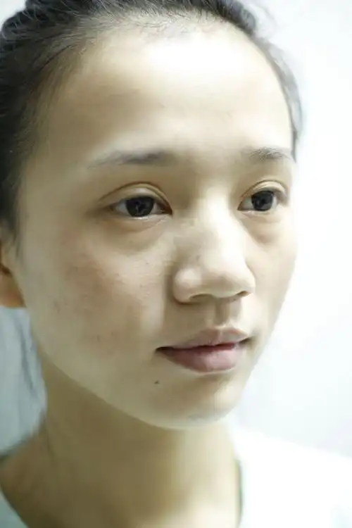 22岁的我终于甩掉了痘印脸现在素颜皮肤也好好