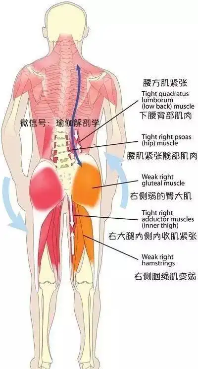 脊柱侧弯的矫正肌——腰方肌