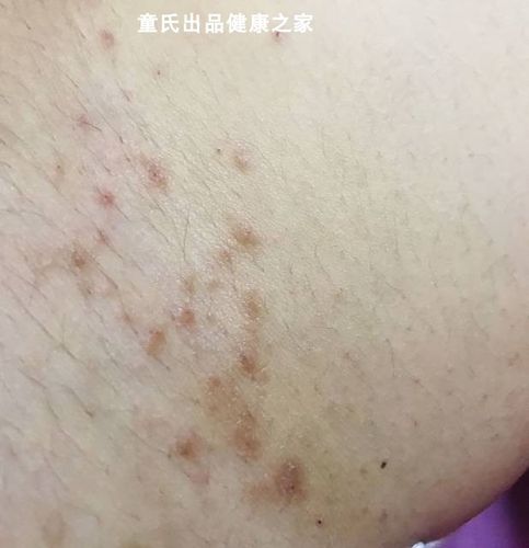 屁眼私密舒外用潮湿肛门外用男性肛周儿童外阴沐浴露