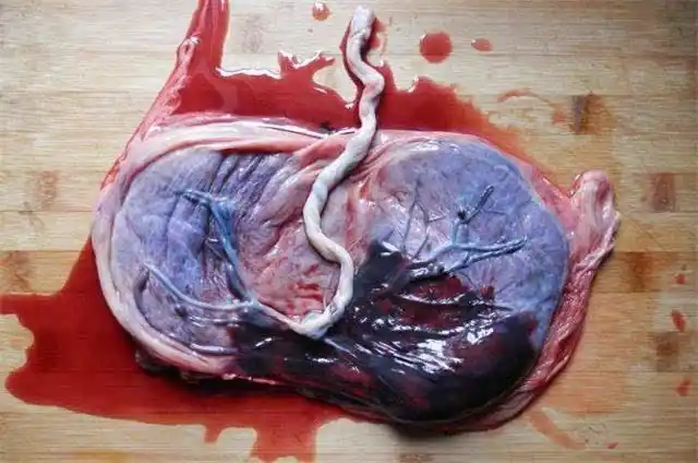 胎盘是什么样子?真的能吃么_大全-幸福起航