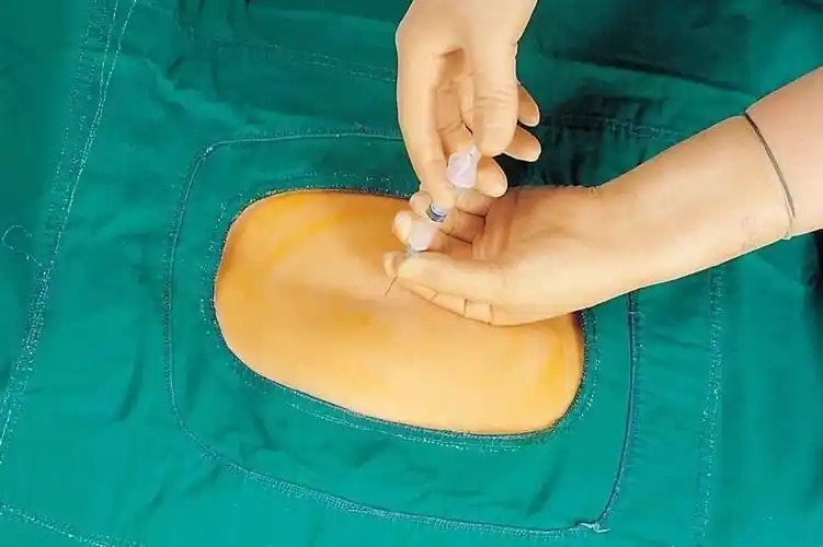 不是所有产妇都能打无痛专家说