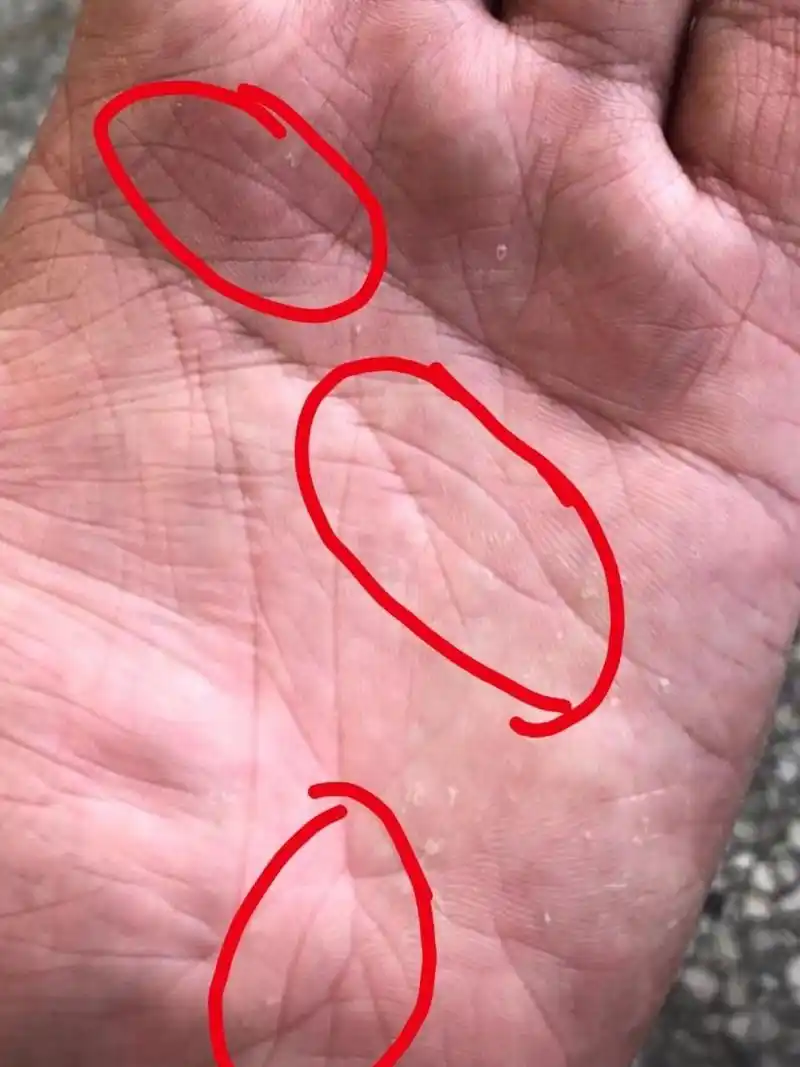 岛纹也是不利纹路,手上岛纹多的,阻碍多,虚空多,梦想大于现实多.