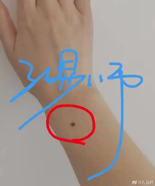 痣相    手腕痣～～贵人指引,贵人帮扶