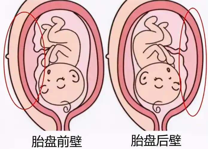 相反胎盘在子宫后面,宝宝的位置随之更靠后,准妈妈并不显肚子大.