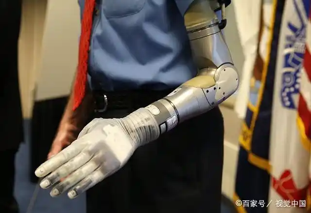 上肢假肢的悬吊装置和控制系统