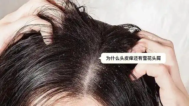 头皮也会因为皮脂分泌量减少患上"换季病"而变得不稳定于是,干痒紧绷