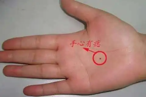 一个人有着掌心痣是福是祸这里全部给你解析
