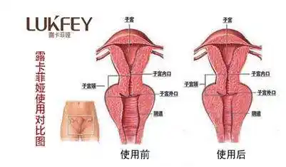 生完孩子顺产后怎么缩阴?掌握产后缩阴小偏方