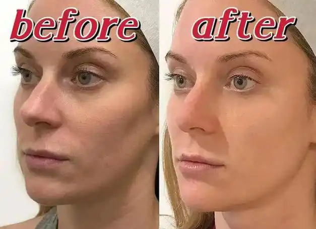 美白|面膜|嫩肤|胶原蛋白|皮肤科医生_网易订阅