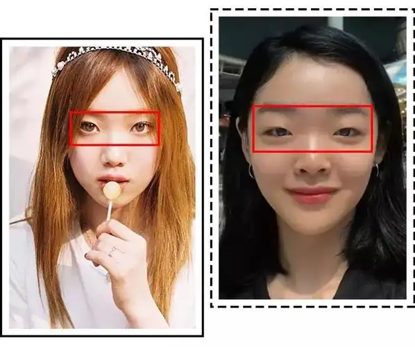 为什么这些女明星塌鼻子也不整女明星鼻子塌陷