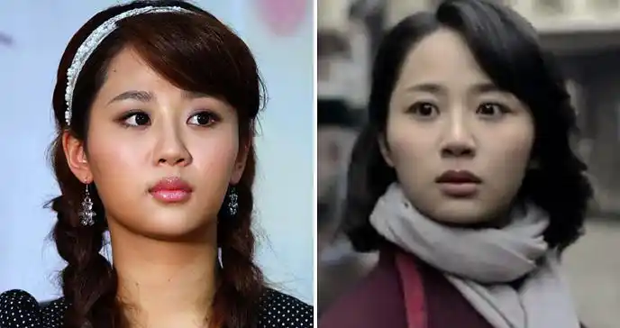 看图,大家觉得杨紫有没有做颧弓内推