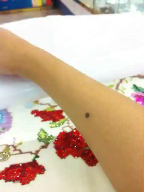 手臂有痣:主生财.手臂有痣者能管理好自己的财位,理财能力强.