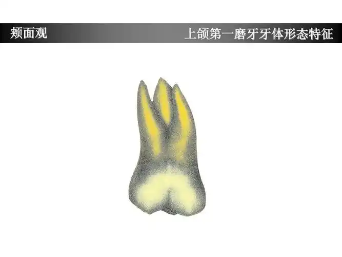 上颌第一磨牙牙体形态简述ppt