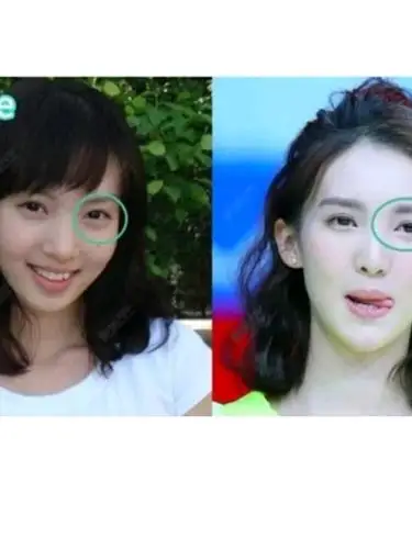 金晨原来整了这么多 难怪是"内地萧亚轩"