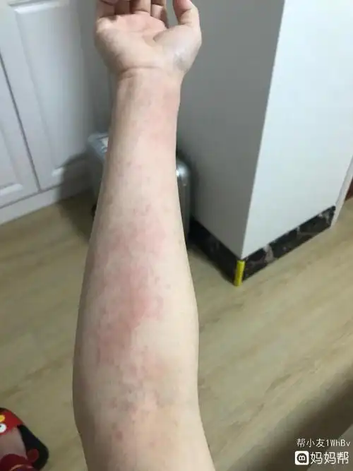 >>小圈子. *猜你喜欢*  孕期妈妈交流qq群:551386295,谢绝男士入群