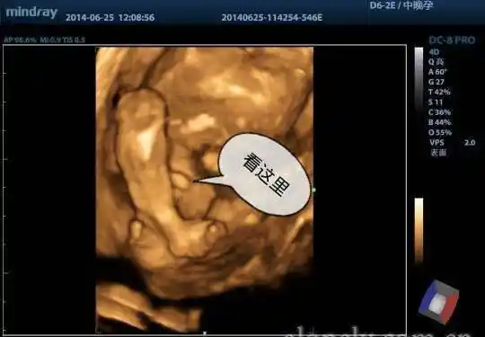 以下就是宝妈做四维看男孩女孩诀窍,参考一下吧:其实,想一堵胎儿芳容