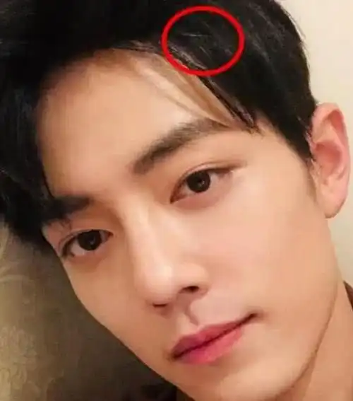 古装男神肖战掀起刘海后发际线太感人粉丝哭晕在厕所
